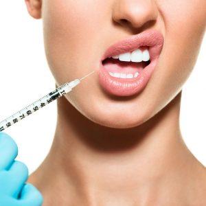 Comment avoir des lèvres pulpeuses sans injections