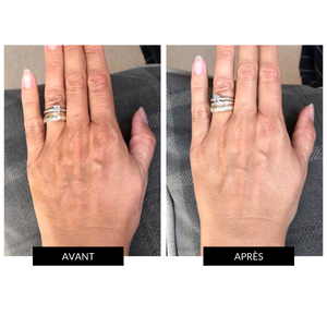 CurrentBody Skin LED Hand Perfector - Appareil soin des mains