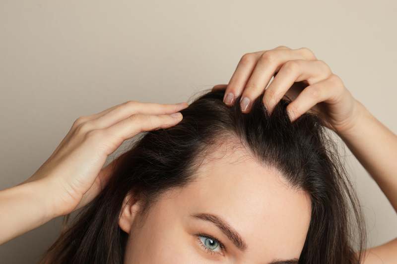 La perte de cheveux chez la femme