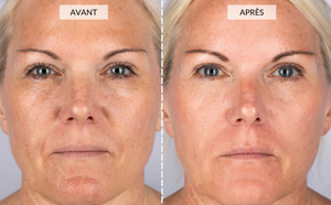 CurrentBody Skin - Le kit visage anti-âge complet