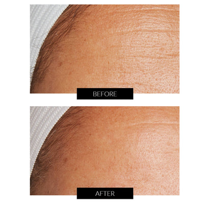 Lancer La Méthode : Soin nourrissant pour peau normale à mixte (50 ml)