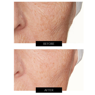 Lancer La Méthode : Soin nourrissant pour peau normale à mixte (50 ml)