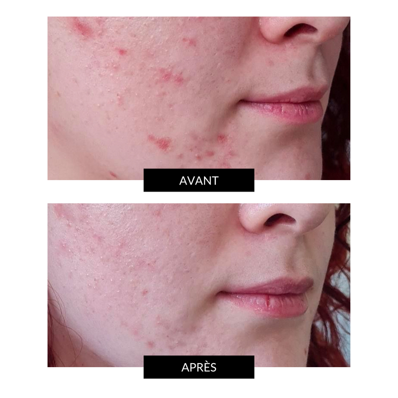 FACEGYM Face Coach Huile Visage (15/30 ml) CurrentBody FR