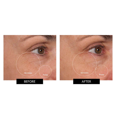 BeautyBio Cryo Duo Rollers