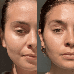 FOREO - Kit complet pour le visage